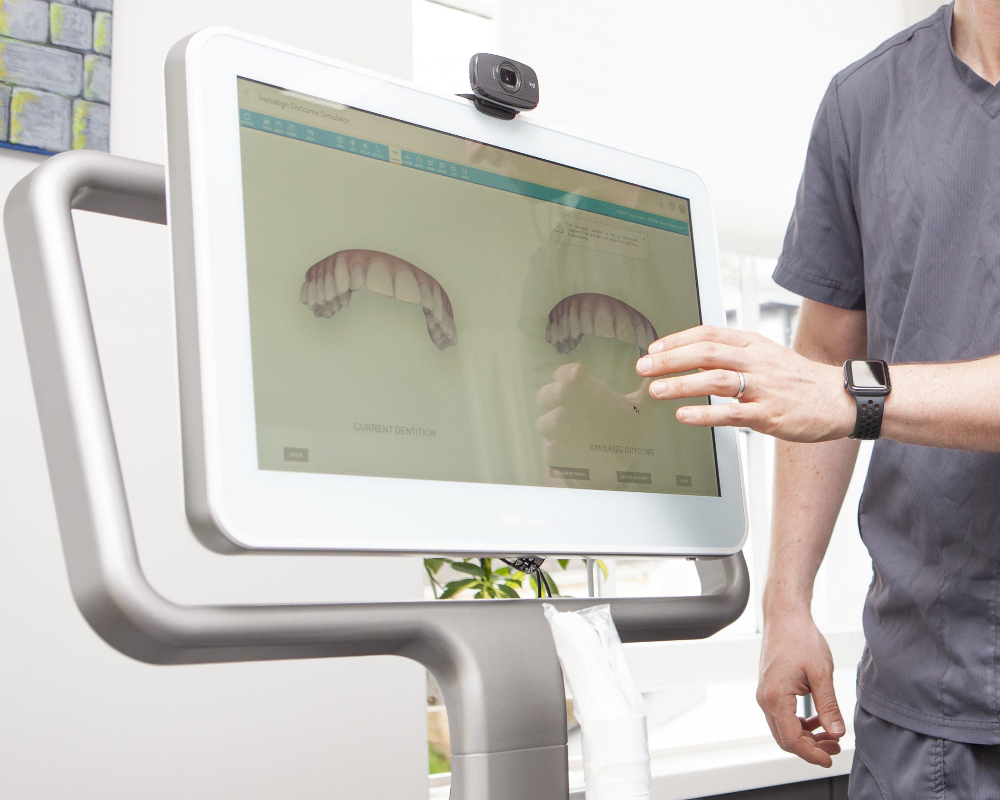 Itero 3d Scanner Wadebridge Dental Care