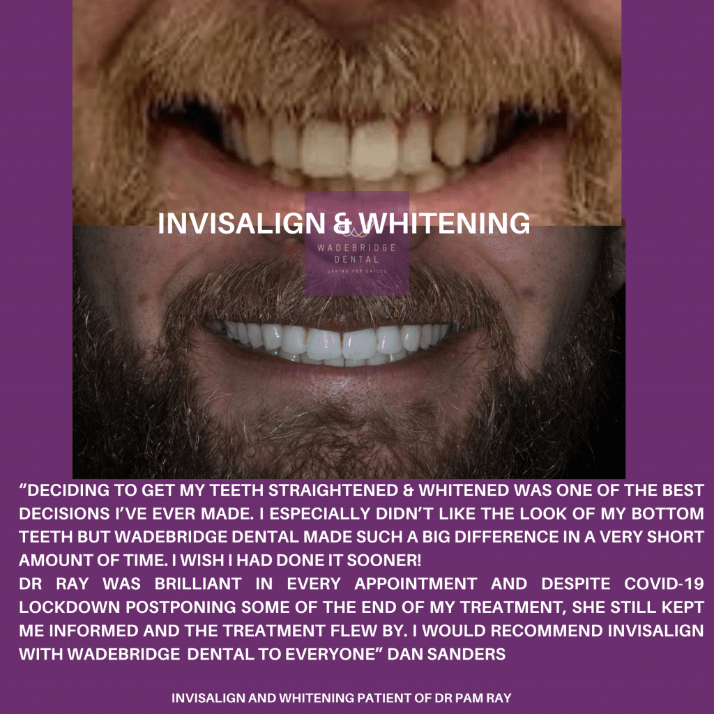 This image has an empty alt attribute; its file name is Dan-Invisalign-1024x1024.png
