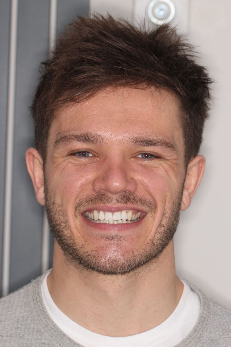 Invisalign, Composite Bonding and implants at Wadebridge Dental, Cornwall